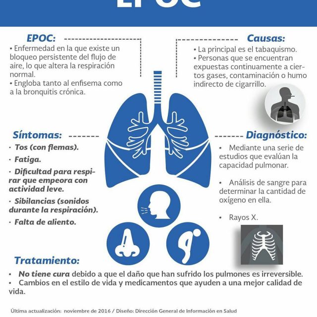 No esperes a que la EPOC te silencie deja dehellip